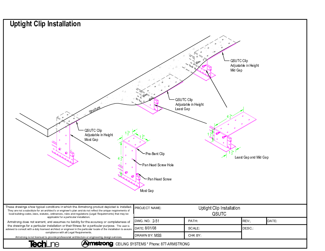 QSUTC - Uptight Clip Installation